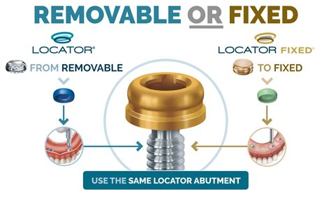 implant metal housing|locator implant attachments.